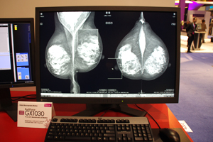 10MsNZ̃}OtBp EIZO RadiForce GX1030