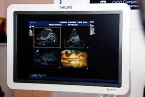 3DC4Df[^̎W\ŁCCӂ̒fwŊώ@\