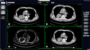 AZE VirtualPlace PHOENIXɂߋ摜Ƃ̃WXg[V