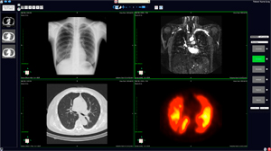 AZE VirtualPlace PHOENIX̓ꊳ҉摜r