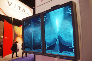 [gVZVXɑΉMammo Tomosynthesis 5MP