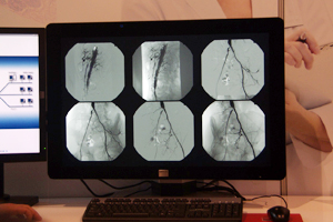 nCGhNXCoronis Fusion 4MP DL