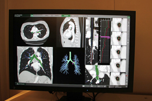 SYNAPSE VINCENT̋Cǎxo@\