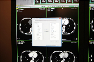 SYNAPSEł̓JX^}CY@\[