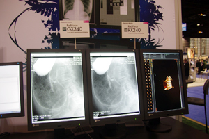 ViRadiForce GX340/RX240