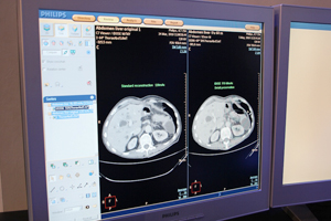 iDose4ł͂莩Rȉ摜č\\ɂȂ