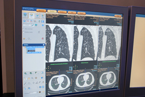 x땔̃Xg[NA[`t@NgጸĂ