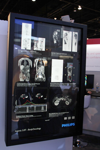 Tumor TrackingȂǃAvP[VՏ摜Љ