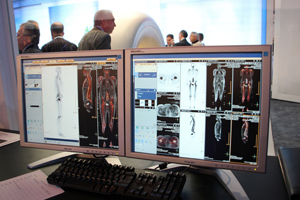 Ingenuity TF PET/MRɂՏ摜iSgj