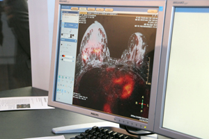 Ingenuity TF PET/MRによる臨床画像（乳がん）