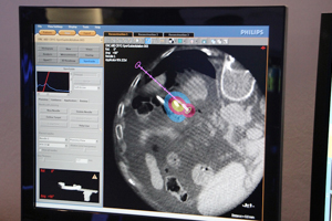 ǎBẽAvP[V XperGuideAbulation