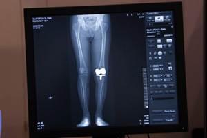 `̈ɂgVZVXilH֐߂̕]j