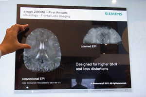 pgX~bg𐶂syngo ZOOMit