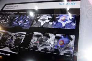 MR-PETPETECT̍̏Wς̔riFPETECTCFMR-PETj