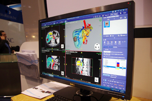 Lobular DecompositioniQloij̃f