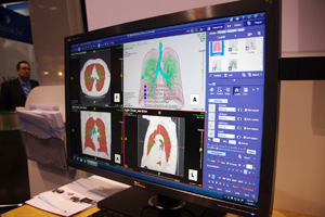 xC̐ffɗLpVolumetric HistogramiQloij