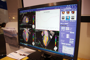 S̕ǉ^]Coronary Territory & Motion MpasiQloij