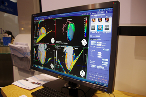 TVA\Time-Volume Analysis & Enhancement AnalysisiQloij