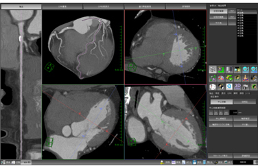 }1@VECT׌ǉ obNOEhZpɂC_uIu[N삪\ɂȂ܂B