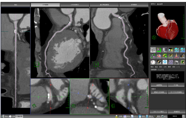 }2@VECT׌ǉ́[CPRdCAEg ACPRⒼfʂɑ΂Ăpx猌ǂ̏Ԃ]ł܂B