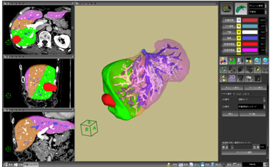 }5@̑̓\tgEFA V_O@p邱ƂŊ̑̌Ǒs𖾊mɕ\܂B