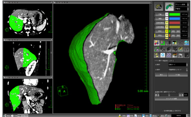 }6@̑̓\tgEFA JbgʂMPR\邱ƂŁCgDɑ΂錌Ǒs𖾊mɕ\ł܂B