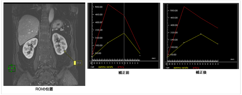 }7@_Ci~bN 4D ␳{Ƃł萸x̍͂sƂł܂B