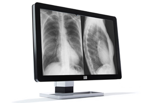 }1@Coronis Fusion 10MP