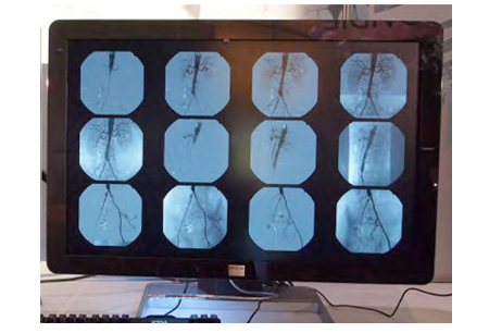 }2@Coronis Fusion 4MP