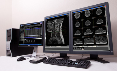 }5@}`_eB摜r[ARadiology Viewer