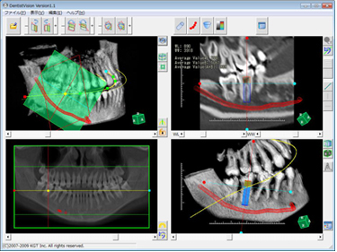 }3@ȗpDICOMr[DentistVision