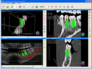 }4@Cvg݌vV~[V@\ꂽProfessional