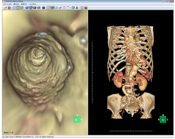 }10@t[CZXINTAGE Volume Player5
