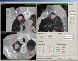 }2@VolumeView̉ʁixj