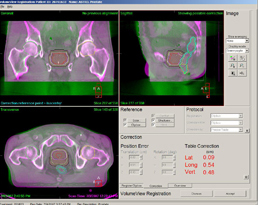 }3@VolumeView̉ʁiOBj