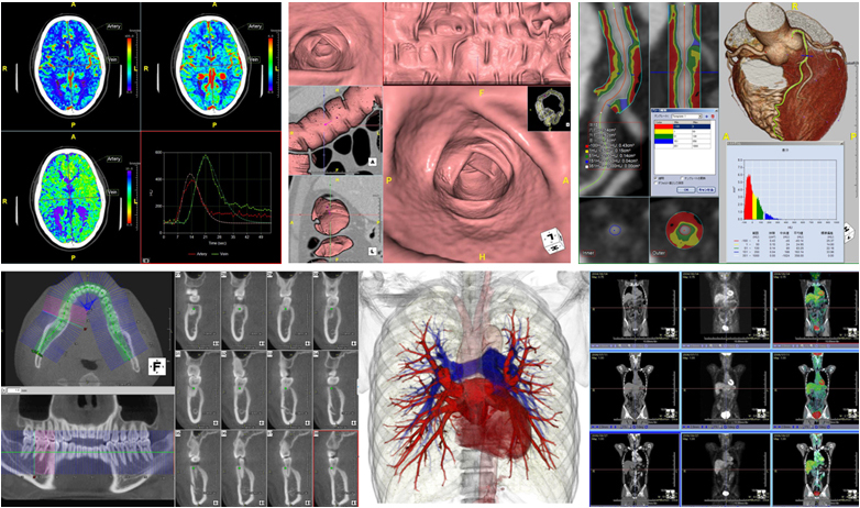 }2@NCAgr[A[ł̊eʂƂ3D