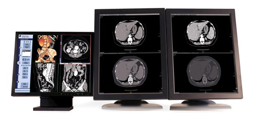 }8@Centricity RA1000