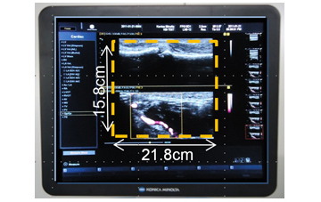 }11@17C`TCY̗p摜\GAg