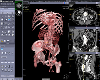 }2@2D3D̃N\ 傫\ꂽVR摜ƁCʉEɕ\ꂽaxial, coronal, sagittal̊efʑ̓}EXNbNő݂ɃNăJ[\\܂B