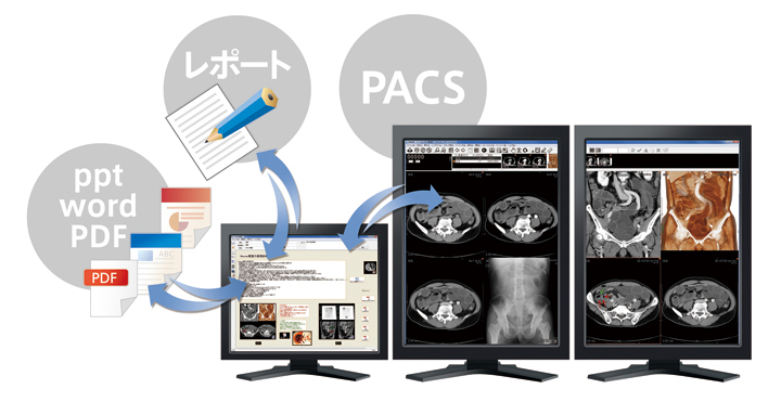 }6@Ǘt@CǗVXe EV Palette