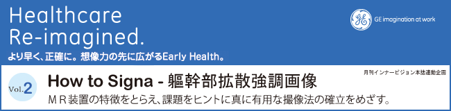 How to Signa - gU摜 MRu̓Ƃ炦Aۑqgɐ^ɗLpȎB@̊m߂B