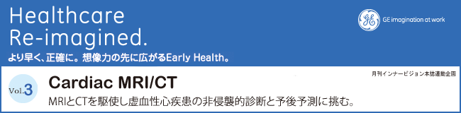 Cardiac MRI/CT - MRIƂbsgS̔NPIffƗ\\ɒށB
