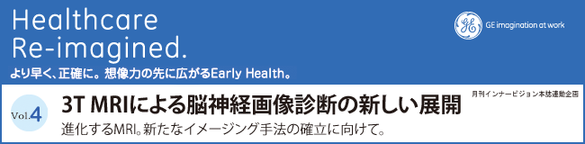Vol.4 3T MRIɂ]_o摜ff̐VWJ - iMRIBVȃC[WO@̊mɌāB