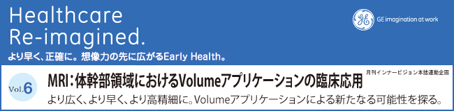 Vol.6 MRIF̊̈ɂVolumeAvP[V̗Տp