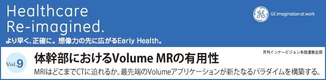 Vol. 9 ̊ɂVolume MR̗Lp MRI͂ǂ܂CTɔ邩BŐ[VolumeAvP[VVȂp_C\zB