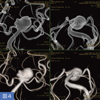 }4@Âɖ𗧂܂܂ȉ摜B2ߑA2Volume RenderingłBᎂƌǂ̊֌WAᎂ̓猩lbN̗lqȂǂ悭킩B