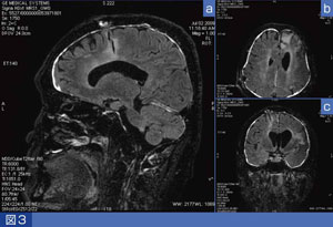 }3@^Ǘ̓eFLAIR-Cube摜@aFFLAIR-Cubef摜@bFFLAIR-Cubeč\f@cFFLAIR-Cubeč\f