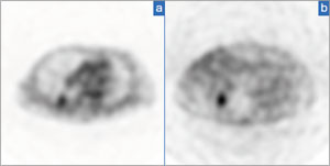 }4@PET̗Տ摜@aFCTz␳@bFCTz␳Ȃ