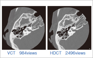 VCTHDCTŎBeꊳ҂̑^[Qbg摜