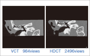 VCTHDCTŎBeꊳ҂̑^[QbgRi摜